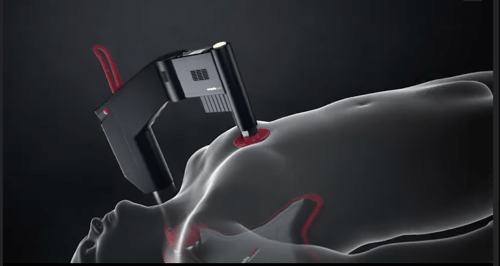 CPR arm with rec board image