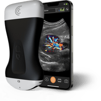 HP-Clarius-HD3-Wireless-Ultrasound-Scanner-Color-Kidney HP-Clarius-HD3-Wireless-Ultrasound-Scanner-Color-Kidney