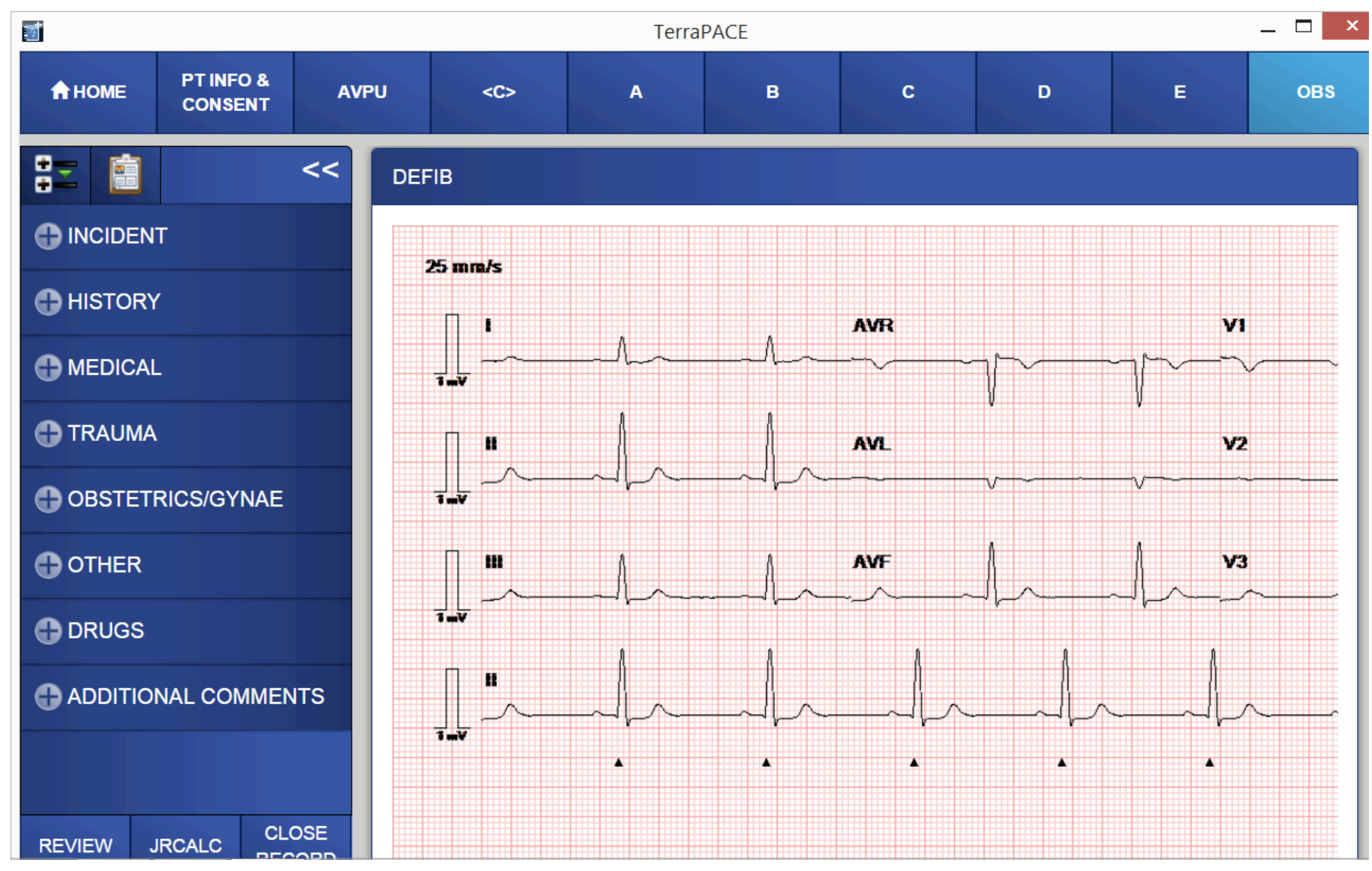 Corpuls C3 and EPRF